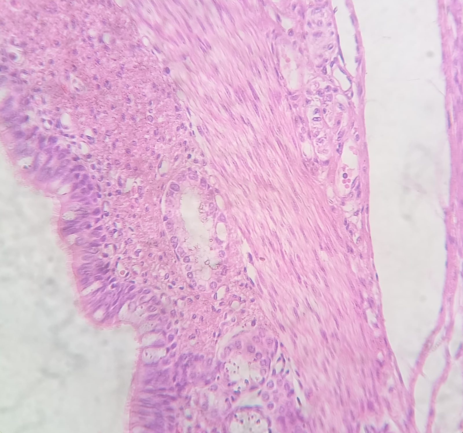 Histological section of large intestine stained pink and purple, showing the epithelial layer and the crypts beneath it