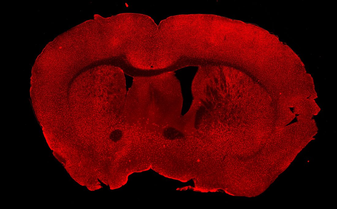 Fluorescence micrograph of a mouse brain coronal section with microglia labelled in red