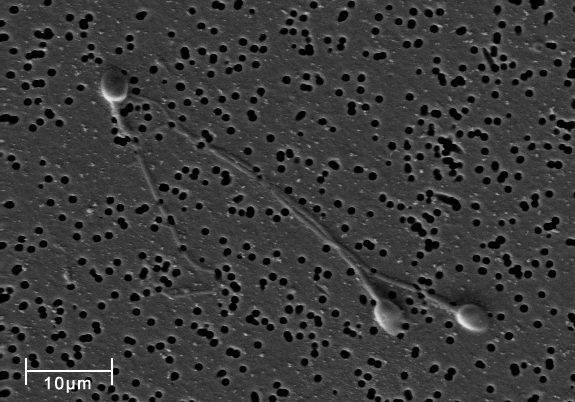 Electron micrograph of several human spermatozoa on a filter membrane, with a ten micrometre scale bar